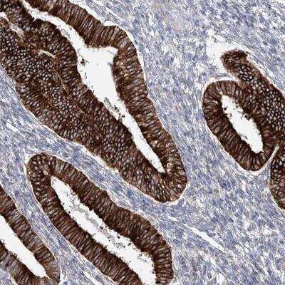 Immunohistochemistry-Paraffin: YTHDC2 Antibody [NBP1-85089]
