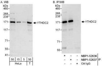 Western Blot: YTHDC2 Antibody [NBP1-52636]