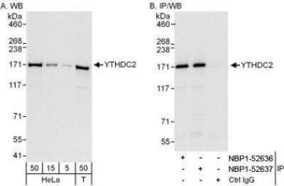 Western Blot: YTHDC2 Antibody [NBP1-52637]