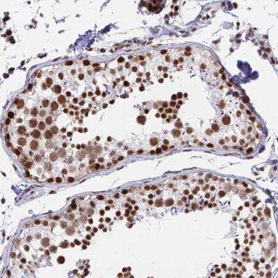 Immunohistochemistry-Paraffin: YTHDF2 Antibody [NBP2-31785]