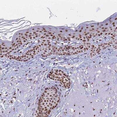 Immunohistochemistry-Paraffin: YTHDF2 Antibody [NBP2-31785]