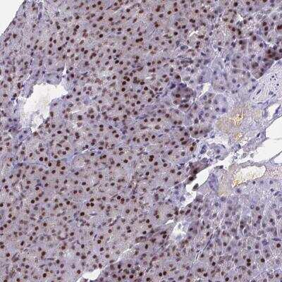 Immunohistochemistry-Paraffin: YTHDF2 Antibody [NBP2-31785]
