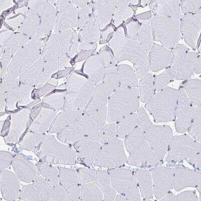 Immunohistochemistry-Paraffin: YTHDF2 Antibody [NBP2-31785]