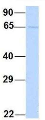 Western Blot: YTHDF3 Antibody [NBP1-56303]
