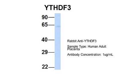 Western Blot: YTHDF3 Antibody [NBP1-56394]