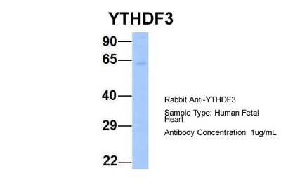 Western Blot: YTHDF3 Antibody [NBP1-56394]