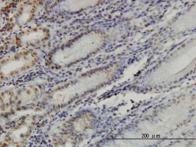 Immunohistochemistry-Paraffin: YY1 Antibody (2C5) [H00007528-M04]
