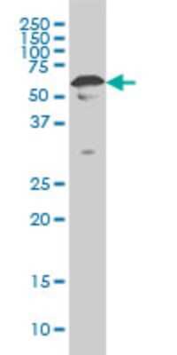 Western Blot: YY1 Antibody (4A5) [H00007528-M02]