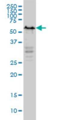Western Blot: YY1 Antibody (4D2) [H00007528-M03]