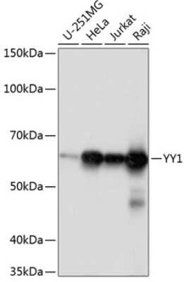Western Blot: YY1 Antibody (6J6L1) [NBP3-15779]
