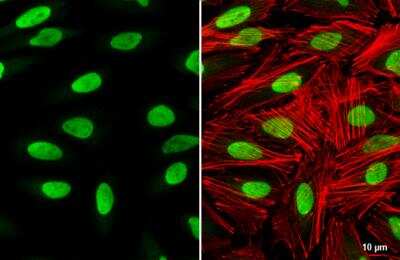 Immunocytochemistry/ Immunofluorescence: YY1 Antibody [NBP2-20932]