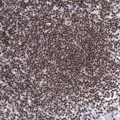Immunohistochemistry-Paraffin: YY1 Antibody [NBP1-85260]
