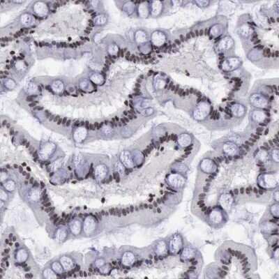 Immunohistochemistry-Paraffin: YY1 Antibody [NBP1-85260]