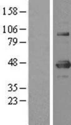 Western Blot: YY1 Overexpression Lysate [NBL1-17953]