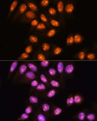 Immunocytochemistry/ Immunofluorescence: YY2 Antibody - Azide and BSA Free [NBP2-93905]