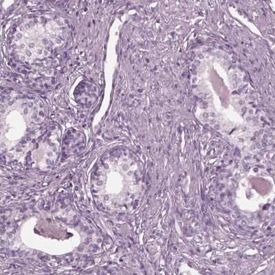 Immunohistochemistry-Paraffin: YY2 Antibody [NBP2-57462]