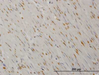 Immunohistochemistry-Paraffin: Yes Antibody (2D5) [H00007525-M03]