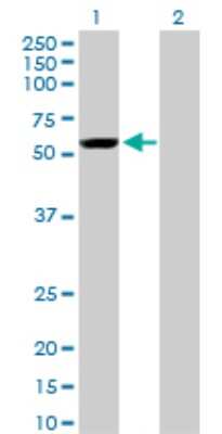 Western Blot: Yes Antibody (2F4) [H00007525-M01]