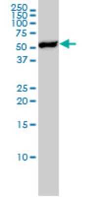 Western Blot: Yes Antibody (3C6) [H00007525-M02]