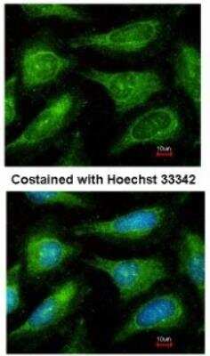 Immunocytochemistry/ Immunofluorescence: Yes Antibody [NBP1-31297]