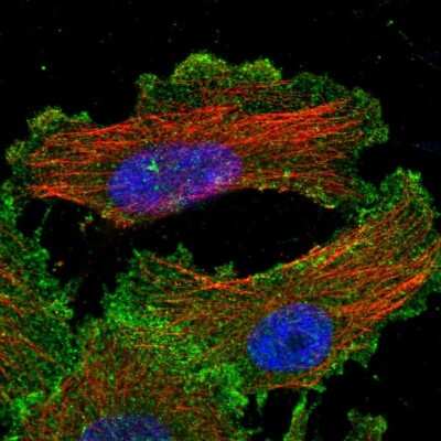 Immunocytochemistry/ Immunofluorescence: Yes Antibody [NBP1-85369]