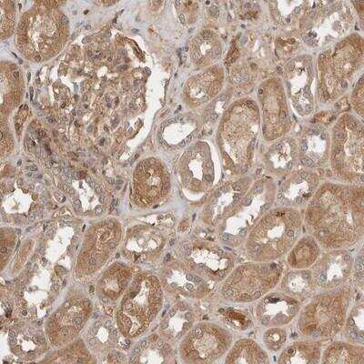 Immunohistochemistry-Paraffin: Yes Antibody [NBP1-85369]