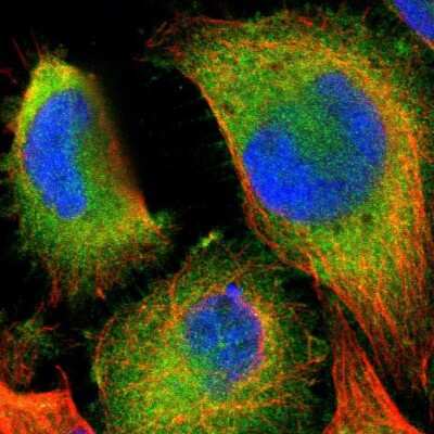 Immunocytochemistry/ Immunofluorescence: Ymer Antibody [NBP1-88265]