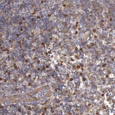 Immunohistochemistry-Paraffin: Ymer Antibody [NBP1-88265]