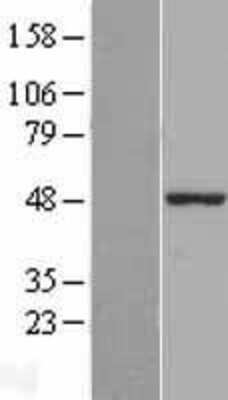 Western Blot: ZBP1/DLM-1/DAI Overexpression Lysate [NBL1-17961]