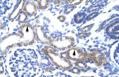 Immunohistochemistry: ZA20D3 Antibody [NBP2-83782]