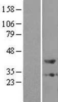 Western Blot: ZADH1 Overexpression Lysate [NBL1-14942]