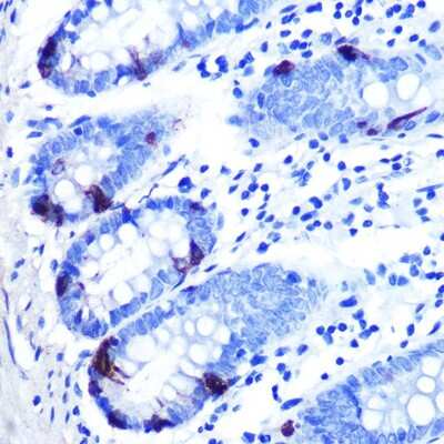 Immunohistochemistry-Paraffin: ZAG Antibody (7I8N3) [NBP3-15426]