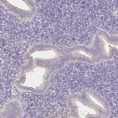 Immunohistochemistry-Paraffin: ZAG Antibody [NBP1-86842]