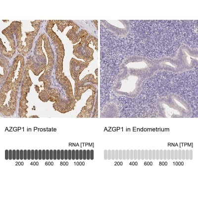 Immunohistochemistry-Paraffin: ZAG Antibody [NBP1-86842]