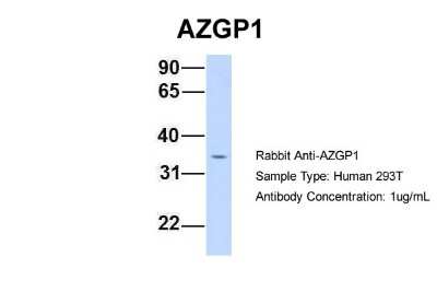 Western Blot: ZAG Antibody [NBP1-59179]