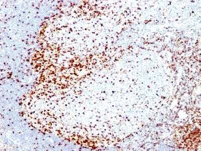 Immunohistochemistry-Paraffin: ZAP70 Antibody (2F3.2) [NBP2-44502]
