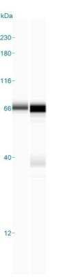 Simple Western: ZAP70 Antibody (2F3.2) [NBP2-44502]