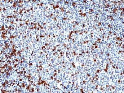 Immunohistochemistry-Paraffin: ZAP70 Antibody (RM408) [NBP2-89104]