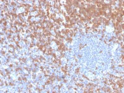Immunohistochemistry-Paraffin: ZAP70 Antibody (ZAP70/4040R) [NBP3-07223]