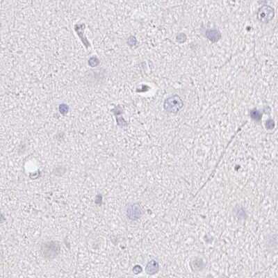 Immunohistochemistry-Paraffin: ZBBX Antibody [NBP2-38294]