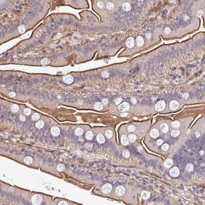 Immunohistochemistry-Paraffin: ZBED3 Antibody [NBP2-33772]
