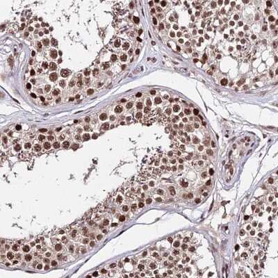 Immunohistochemistry-Paraffin: ZBED4 Antibody [NBP2-13531]