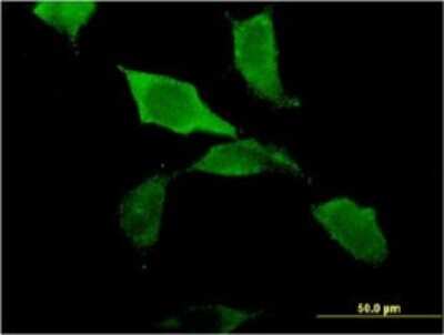 Immunocytochemistry/ Immunofluorescence: ZBP1/DLM-1/DAI Antibody (2C10) [H00081030-M01]