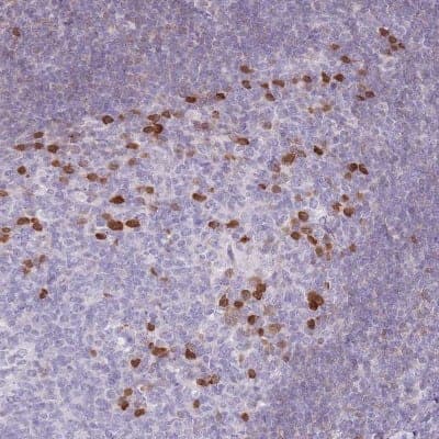 Immunohistochemistry-Paraffin: ZBP1/DLM-1/DAI Antibody [NBP2-14793]
