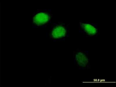 Immunocytochemistry/ Immunofluorescence: ZBTB12 Antibody [H00221527-B01P]