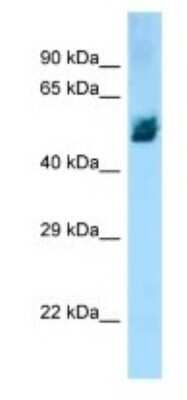 Western Blot: ZBTB12 Antibody [NBP1-98350]