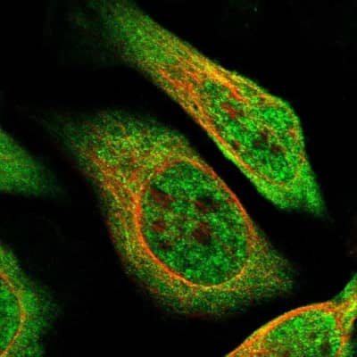 Immunocytochemistry/ Immunofluorescence: ZBTB2 Antibody [NBP1-88786]