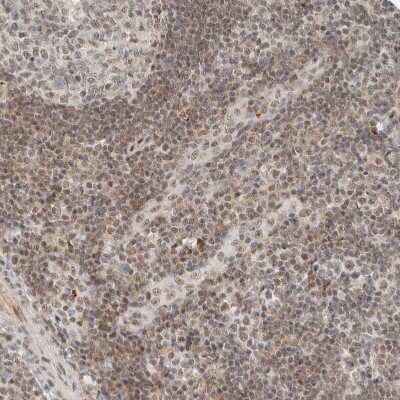 Immunohistochemistry-Paraffin: ZBTB2 Antibody [NBP1-88787]