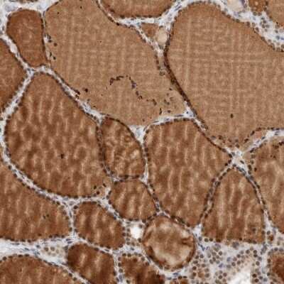 Immunohistochemistry-Paraffin: ZBTB2 Antibody [NBP1-88787]
