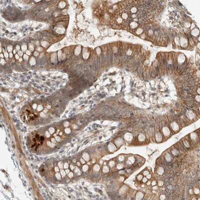 Immunohistochemistry-Paraffin: ZBTB2 Antibody [NBP1-88789]